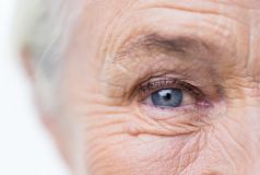 elderly person eye_xs_59815712.jpg